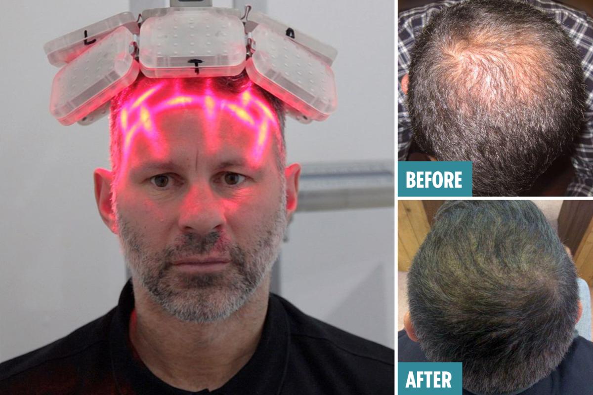 激光手術(shù)費(fèi)用詳解，多少錢一次？，激光手術(shù)費(fèi)用全面解析，手術(shù)費(fèi)用究竟是多少？