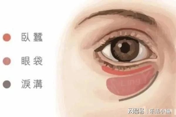 眼袋切除手術(shù)費(fèi)用詳解，價(jià)格因素與如何選擇合適的手術(shù)方案，眼袋切除手術(shù)費(fèi)用解析，了解價(jià)格因素與選擇最佳手術(shù)方案