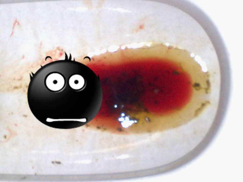 拉屎出血但不疼，原因分析及應(yīng)對(duì)措施，拉屎出血但不疼，原因解析與應(yīng)對(duì)策略