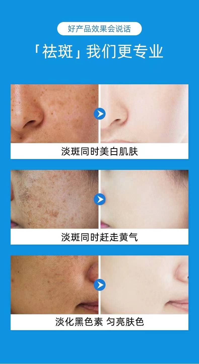 揭秘祛斑最佳方法，如何達到最佳祛斑效果？，揭秘最佳祛斑方法，實現(xiàn)最佳效果的秘訣！