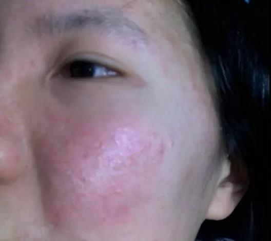 保養(yǎng)皮膚的最好方法，保養(yǎng)皮膚的最佳方法