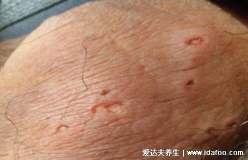 得性疾病前兆，了解、預防與應對，得性疾病的早期信號，了解、預防與應對策略